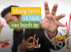 Người cao huyết áp có dùng được nhung hươu không? {Tư vấn sức khỏe}